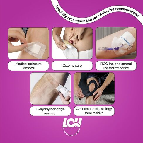 50 قيراط مناديل لاصقة كبيرة لإزالة اللاصق - 5 × 7 بوصة 60 جرام في المتر المربع مزيل لاصق طبي للبشرة - مزيل لاصق للضمادات - مناديل لاصقة للشريط والضمادات وبقايا الفغرة من ليفاكلين هيلث in Kuwait