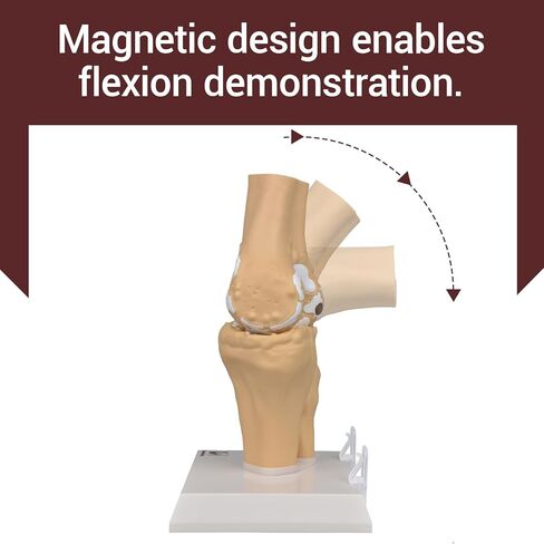 Human Osteoarthritis Knee Joint Anatomic Model, 1:1 Life-Size Skeleton Models for Medical Teaching Demonstration，Anatomy Model for Doctor's Office and Classrooms in Kuwait