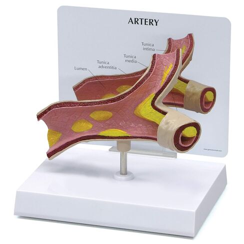 GPI Anatomicals - Artery Model, Replica of an Artery with Cholesterol Deposits for Human Anatomy and Physiology Education, Anatomy Model for Doctor's Office and Classrooms, Medical Learning Resources in Kuwait