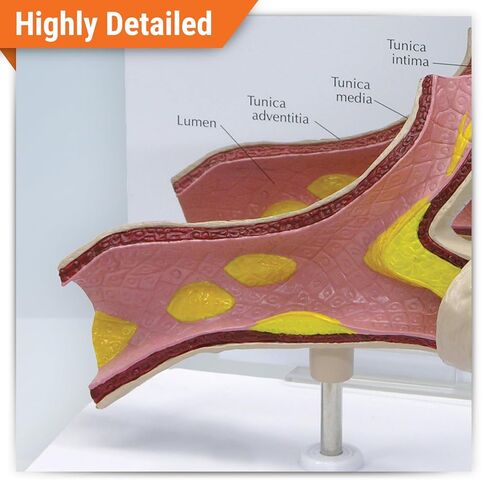 GPI Anatomicals - Artery Model, Replica of an Artery with Cholesterol Deposits for Human Anatomy and Physiology Education, Anatomy Model for Doctor's Office and Classrooms, Medical Learning Resources in Kuwait