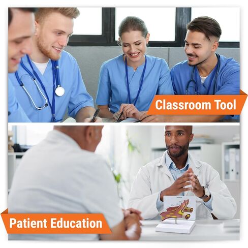 GPI Anatomicals - Artery Model, Replica of an Artery with Cholesterol Deposits for Human Anatomy and Physiology Education, Anatomy Model for Doctor's Office and Classrooms, Medical Learning Resources in Kuwait