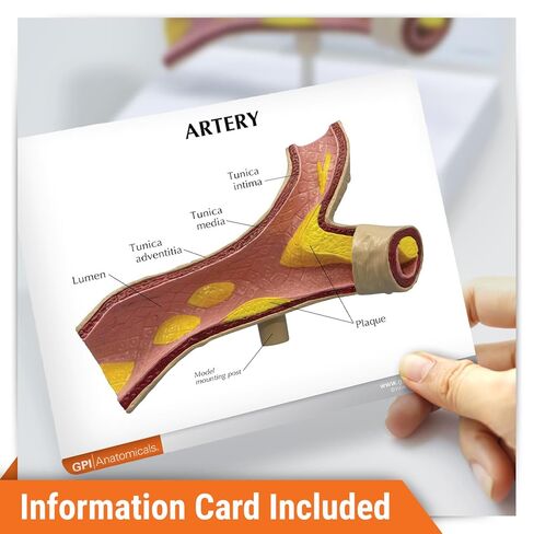GPI Anatomicals - Artery Model, Replica of an Artery with Cholesterol Deposits for Human Anatomy and Physiology Education, Anatomy Model for Doctor's Office and Classrooms, Medical Learning Resources in Kuwait