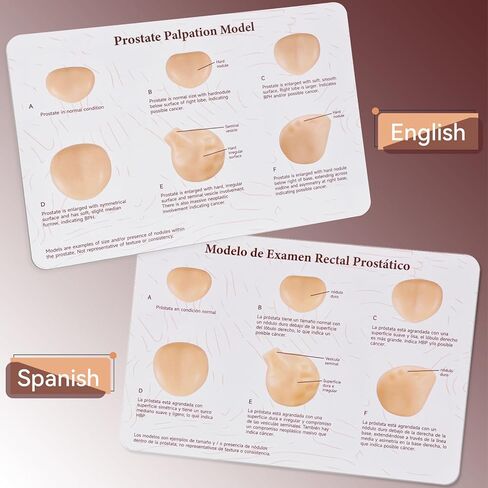 Prostate Palpation Anatomy Model - Male Reproductive System Genital Organ, Adult Male Sagittal Anatomy Model, Silicone Prostate Lesion Training Set for Medical Learning Resources in Kuwait