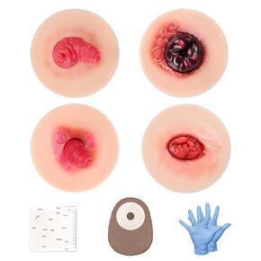 Sticky Unhealthy & Abnormal Stoma Simulation Models, Ostomy Care Practice Set, Stoma Care Training Kit for Nursing & Medical Education in Kuwait