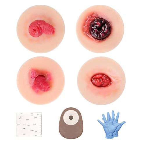 Sticky Unhealthy & Abnormal Stoma Simulation Models, Ostomy Care Practice Set, Stoma Care Training Kit for Nursing & Medical Education in Kuwait