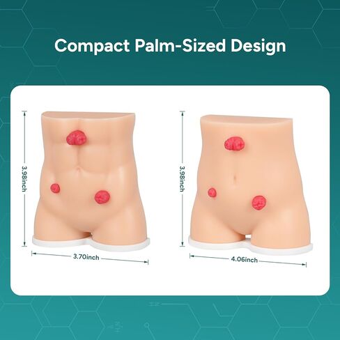 Stoma Demonstration Models Set of 2,Silicone Ostomy Simulator for Medical Teaching & Patient Education in Kuwait
