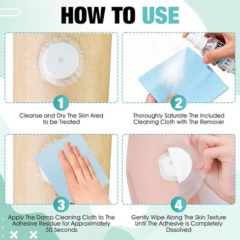 OverZyn 2 oz Skin Adhesive Remover, Bandage Adhesive Remover, Ostomy Adhesive Remover Spray, Quick-Peeling, Suitable for Removing adhesives Such As Skin Tape, Sports Tape, and Ostomy Tape in Kuwait