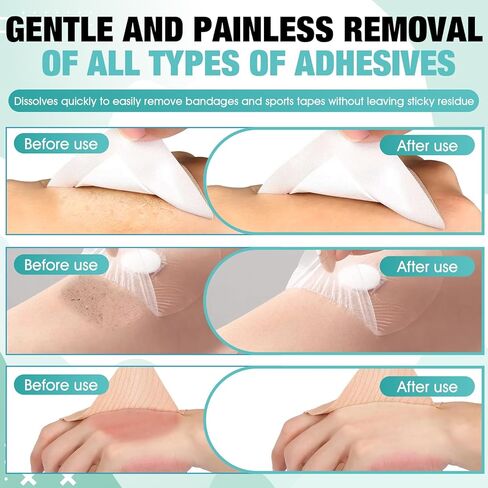 OverZyn 2 oz Skin Adhesive Remover, Bandage Adhesive Remover, Ostomy Adhesive Remover Spray, Quick-Peeling, Suitable for Removing adhesives Such As Skin Tape, Sports Tape, and Ostomy Tape in Kuwait