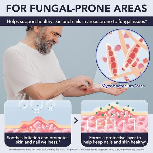 علاج فطريات أظافر القدم بقوة إضافية، قلم فطريات الأظافر، 25% حمض غير ديسيلينيك مع زيت شجرة الشاي المضاف، الجوجوبا، زيوت برعم القرنفل والصبار، محلول سريع المفعول لفطريات أصابع القدم والأظافر، 5 قطع in Kuwait