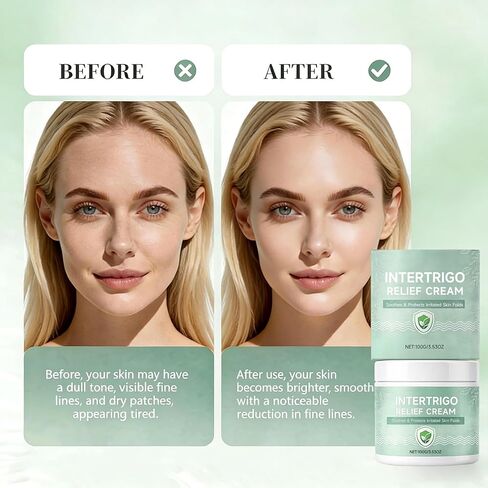 POSOJPIP Intertrigo Cream,Skin Fold Barrier Cream for Moisture & Friction Protection, Helps Support Skin Comfort, Fast-Drying Non-Greasy Formula for Friction-Prone Areas. in Kuwait