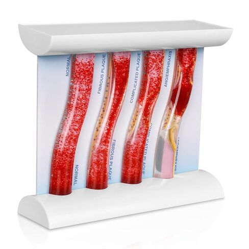 SimCoach Low-Density Lipoprotein LDL Blood Vessel Model for Medical Patient Doctor Teaching, Vascular Demonstration Training Tool, Large Size in Kuwait