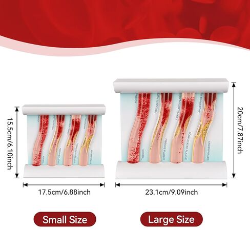 SimCoach Low-Density Lipoprotein LDL Blood Vessel Model for Medical Patient Doctor Teaching, Vascular Demonstration Training Tool, Large Size in Kuwait