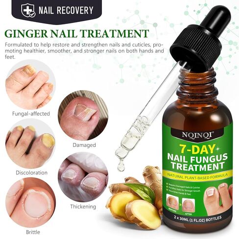7 Days Nail Fungus Treatment Extra Strength, Toe Nail Growth Oil, Ginger Nail Growth Serum, Foot Toenail Serum for Brittle Thin Damaged Nails Strengther and Growth, Repairs Cuticles - 2 Pcs 1 Pack in Saudi Arabia