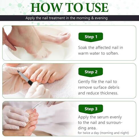 7 Days Nail Fungus Treatment Extra Strength, Toe Nail Growth Oil, Ginger Nail Growth Serum, Foot Toenail Serum for Brittle Thin Damaged Nails Strengther and Growth, Repairs Cuticles - 2 Pcs 1 Pack in Saudi Arabia