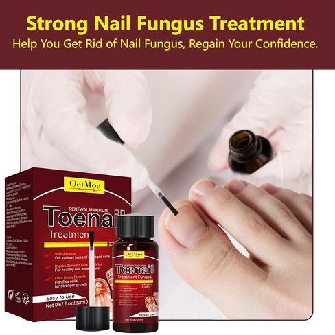 Toenail Fungus Treatment Extra Strength, Nail Fungus Treatment for Yellow, Thick, Discolored, Broken Nails, Ultimate Fungal Nail Repair, Make Nails Look Healthier Stronger, 2 Bottles in Saudi Arabia