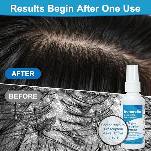 سائل ايفرمكتين 0.5% لعلاج القمل للبالغين (4 أونصة سائلة)، سريع المفعول، علاج قوي لقمل الرأس والبيض، تركيبة سائلة موضعية، للبالغين in Kuwait