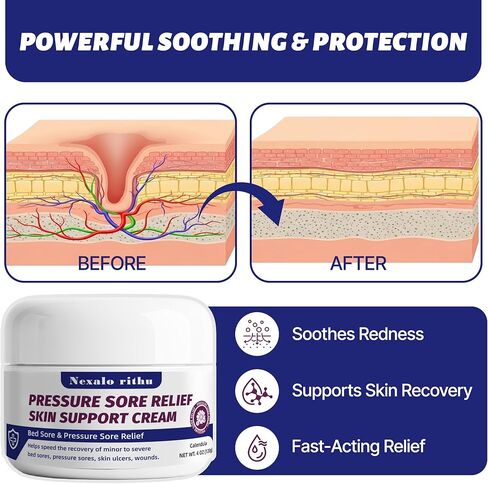كريم قرح الفراش وكريم قرح الضغط مع الآذريون والصبار - عناية يومية لطيفة لقروح الفراش والقرح والجلد المتهيج، يوفر دعمًا مهدئًا، كريم علاج قرح السرير للاستخدام المنزلي والتمريضي in Kuwait