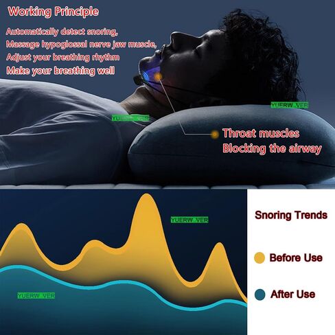 Anti Snoring Devices Intelligent Electric Snoring Solution Smart Throat Effective Snore Stopper Good Sleep Aid Device for Men Women Reduce Snoring in Kuwait