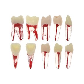 10 قطعة نموذج قناة الأسنان ملف اللبية RCT ممارسة اللب الجذر لدراسة التدريس in Kuwait