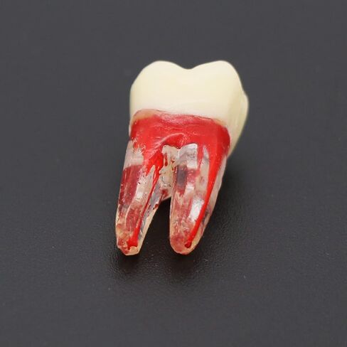 10 قطعة نموذج قناة الأسنان ملف اللبية RCT ممارسة اللب الجذر لدراسة التدريس in Kuwait