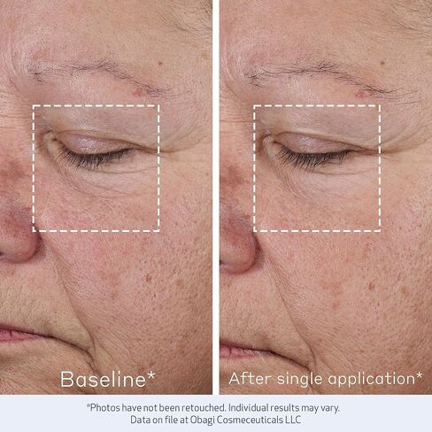 Obagi ELASTIderm Advanced Filler Concentrate – Clinically Proven Non-Injectable Filler with Biomimetic Peptide Technology that Firms Skin & Reduces the Appearance of Fine Lines & Wrinkles in Kuwait