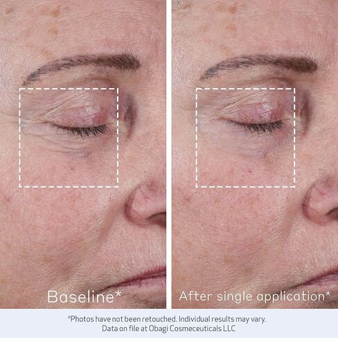 Obagi ELASTIderm Advanced Filler Concentrate – Clinically Proven Non-Injectable Filler with Biomimetic Peptide Technology that Firms Skin & Reduces the Appearance of Fine Lines & Wrinkles in Kuwait