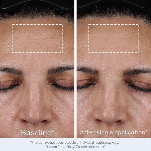 Obagi ELASTIderm Advanced Filler Concentrate – Clinically Proven Non-Injectable Filler with Biomimetic Peptide Technology that Firms Skin & Reduces the Appearance of Fine Lines & Wrinkles in Kuwait