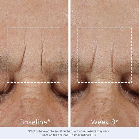 Obagi ELASTIderm Advanced Filler Concentrate – Clinically Proven Non-Injectable Filler with Biomimetic Peptide Technology that Firms Skin & Reduces the Appearance of Fine Lines & Wrinkles in Saudi Arabia