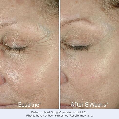 Obagi ELASTIderm Eye Cream – Lightweight, Smooth Formula Clinically Proven to Help Reduce the Appearance of Fine Lines & Wrinkles in Kuwait