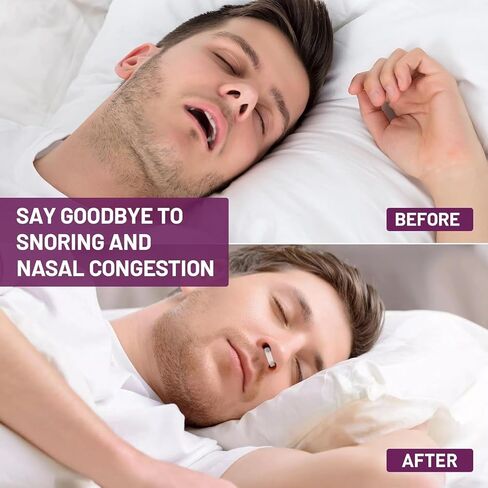 Nasal Dilator for Quiet Nights, Breathing and Snoring Relief | Nasal Strip Alternative| Reusable & Adjustable | Drug-Free Airflow Boost, Snoring Solution in Saudi Arabia