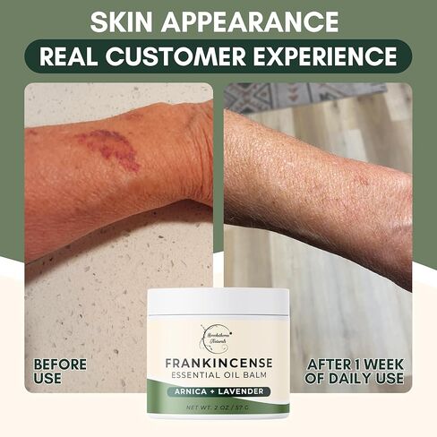 بلسم اللبان الطبيعي من بروكثورن | بلسم زيت اللبان العطري لترطيب البشرة | تهدئة العضلات ودعم المفاصل | مستخلص بوسويليا، أرنيكا مونتانا، زيت الخروع واللافندر 2 أونصة in Kuwait