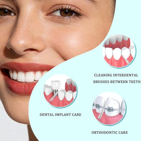 100 Pcs Interdental Brushes, Braces Brush,8 Sizes for Interdental Cleaning, Braces Care Toothpick Flossers, Oral Dental Hygiene Floss, Toothpick Cleaners, Dental Care Tools (10 Colors) in Kuwait