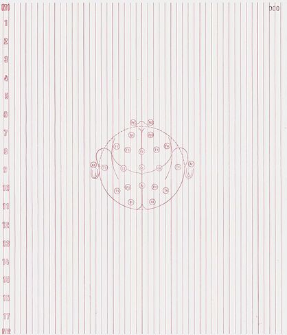 ورق EEG لـ Nicolet 1A97 (345 مم × 300 مم × 1000 ورقة قنوات حمراء 6 مم) 220-703400 (2) in Kuwait