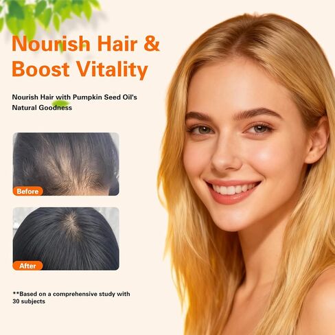 زيت بذور اليقطين لنمو الشعر بالميتو المنشاري | 3000 مجم لكل جرعة، 300 كبسولة هلامية | يدعم صحة المسالك البولية والبروستاتا | معصور على البارد، غني بالأحماض الدهنية والفيتوستيرول، غير معدل وراثيًا in Kuwait