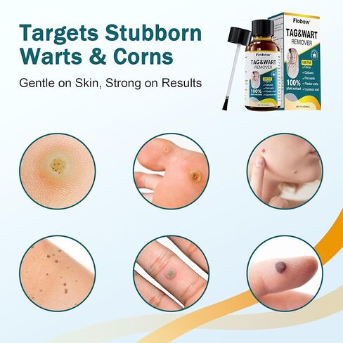 تجميد مزيل البث المزيل من 1 أوقية مزيل الذرة للأصابع 15 ٪ مزيل ثؤلول حمض الساليسيليك من أجل ثؤلول أخمصي ، ثؤلول مشتركة ، ثؤلول مسطحة ، الذرة ، الكالس in Kuwait