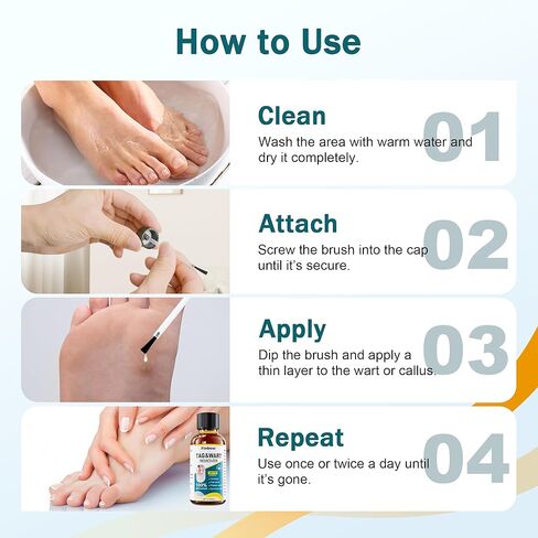 تجميد مزيل البث المزيل من 1 أوقية مزيل الذرة للأصابع 15 ٪ مزيل ثؤلول حمض الساليسيليك من أجل ثؤلول أخمصي ، ثؤلول مشتركة ، ثؤلول مسطحة ، الذرة ، الكالس in Kuwait