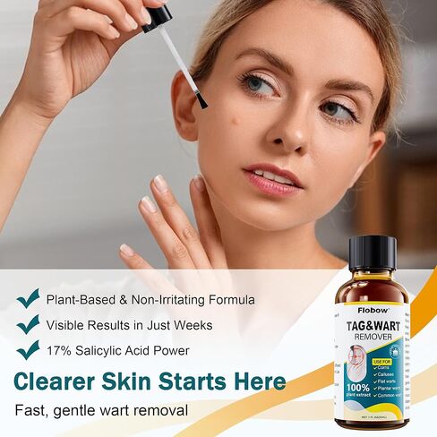 تجميد مزيل البث المزيل من 1 أوقية مزيل الذرة للأصابع 15 ٪ مزيل ثؤلول حمض الساليسيليك من أجل ثؤلول أخمصي ، ثؤلول مشتركة ، ثؤلول مسطحة ، الذرة ، الكالس in Kuwait