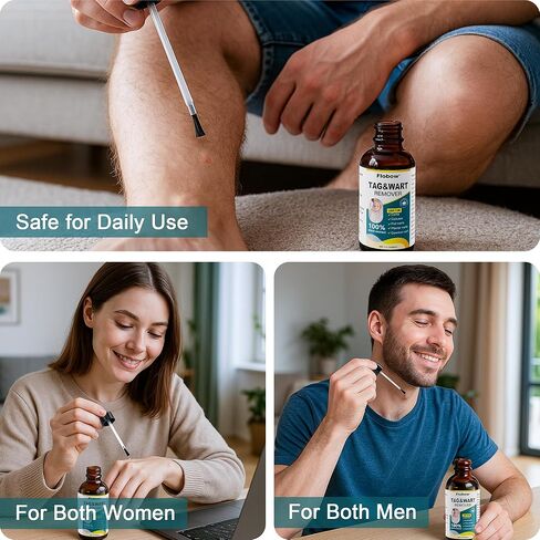 تجميد مزيل البث المزيل من 1 أوقية مزيل الذرة للأصابع 15 ٪ مزيل ثؤلول حمض الساليسيليك من أجل ثؤلول أخمصي ، ثؤلول مشتركة ، ثؤلول مسطحة ، الذرة ، الكالس in Kuwait