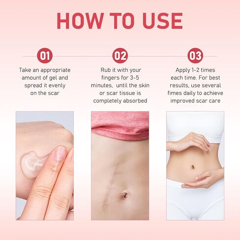 كريم مهدئ للندبات وكريم تنعيم للندبات، يساعد على تحسين المظهر، ويقلل الاحمرار، تركيبة خفيفة الوزن وغير دهنية (قطعتان) in Kuwait