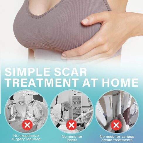 أوراق ندبات سيليكون ناعمة للثدي، أوراق ندبات سيليكون قابلة للتنفس للندبات الجراحية، أوراق ندبات سيليكون رفيعة للغاية للتخلص من الندبات بعد الجراحة، شريط طبي مرن، 4 أزواج in Kuwait