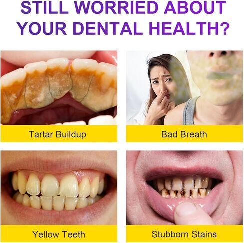 Enamel-Safe Teeth Whitening Powder – Gentle on Teeth – No Sensitivity Formula – Removes Stains – 15g Breath Freshening Whitening Powder in Kuwait