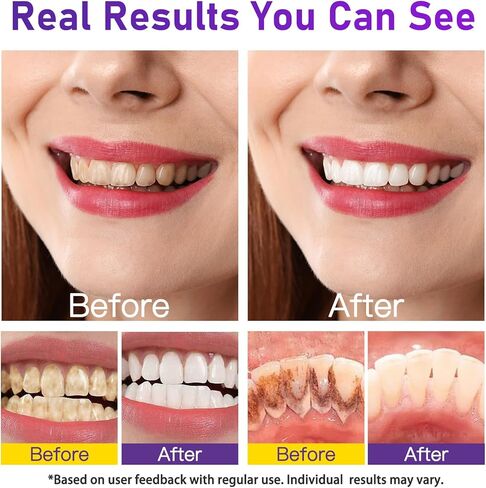 Enamel-Safe Teeth Whitening Powder – Gentle on Teeth – No Sensitivity Formula – Removes Stains – 15g Breath Freshening Whitening Powder in Kuwait