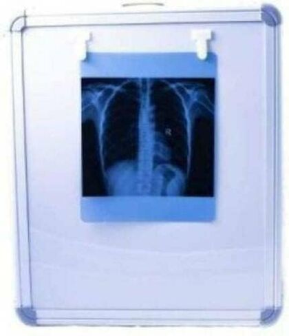 صندوق عرض مصباح LED X Ray مزود بتنشيط تلقائي للفيلم وسطوع متغير in Kuwait