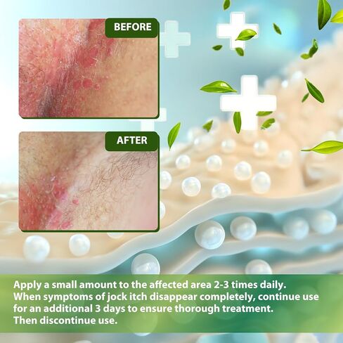 Jock Itch Antifungal Skin Cream: Tea Tree Oil Anti Fungal Cream with Aloe Vera, Lavender & Eucalyptus – Extra Strength Herbal Moisturizer for Itchy Skin Soothing– for Men & Women, 30g in Saudi Arabia