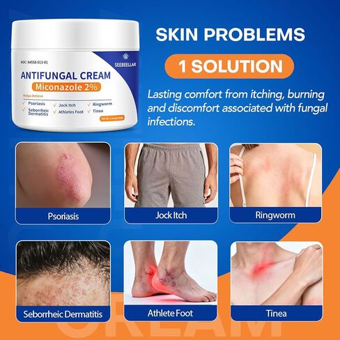 Antifungal Cream for Athletes Foot Jock Itch Ringworm Seborrheic Dermatitis Folliculitis Tinea Miconazole 2% Skin Fungus Relief Anti Fungal Athletes Foot Treatment for Humans 3.4 oz, 100g in Saudi Arabia