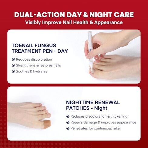 مجموعة علاج فطريات أظافر القدم تريتونيك: علاج مضاد للفطريات لفطريات الأظافر بقوة إضافية مع 25% حمض غير ديسيلينيك (3 أقلام) و32 رقعة أظافر فطرية ليلية - تعمل على إصلاح تلف الأظافر واستعادة لونها in Kuwait