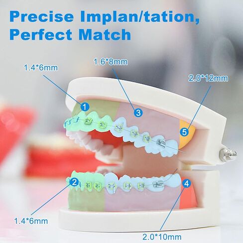 Micro Im/plant Screw Kit, 10Pcs Micro Anchorage Screws and Stainless Steel Screwdriver Wrench, Detachable Design for Teaching Applications HZKD-01 in Kuwait