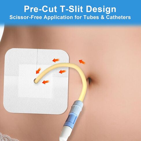 20 حزمة من الضمادات اللاصقة المقسمة لقسطرة PD وأنابيب التغذية، وملحقات غسيل الكلى على شكل جزيرة مقاس 4 × 4 بوصة مع حدود لتأمين أنبوب G وأنبوب J ومواقع الصرف، مغلفة بشكل فردي in Kuwait