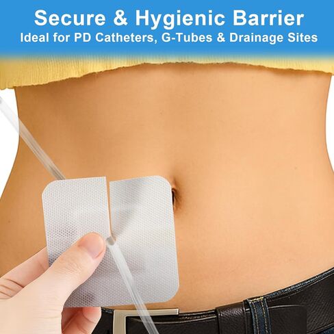 20 حزمة من الضمادات اللاصقة المقسمة لقسطرة PD وأنابيب التغذية، وملحقات غسيل الكلى على شكل جزيرة مقاس 4 × 4 بوصة مع حدود لتأمين أنبوب G وأنبوب J ومواقع الصرف، مغلفة بشكل فردي in Kuwait