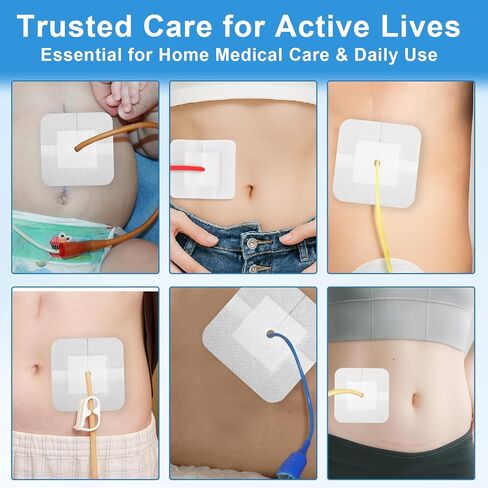 20 حزمة من الضمادات اللاصقة المقسمة لقسطرة PD وأنابيب التغذية، وملحقات غسيل الكلى على شكل جزيرة مقاس 4 × 4 بوصة مع حدود لتأمين أنبوب G وأنبوب J ومواقع الصرف، مغلفة بشكل فردي in Kuwait